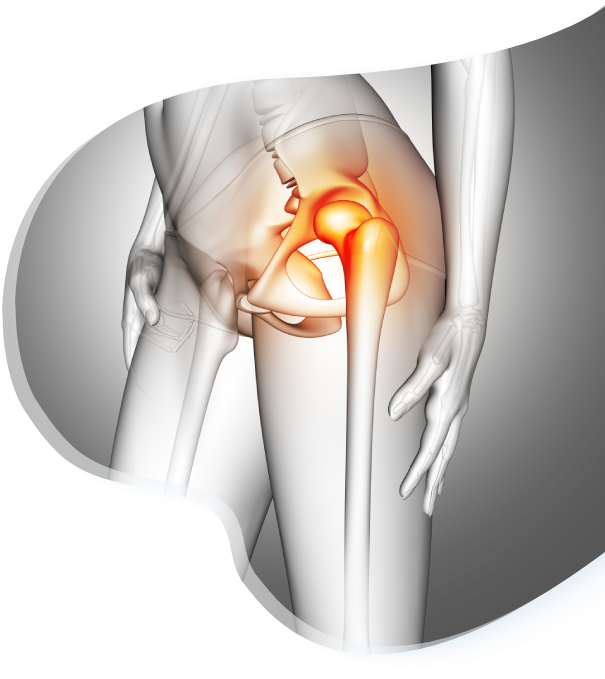 image representing pain in hip bone