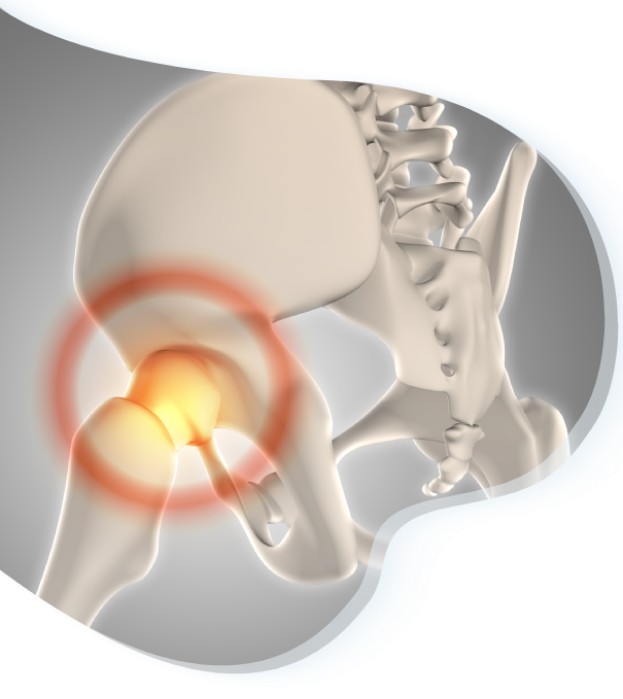 image representing pain in hip bone