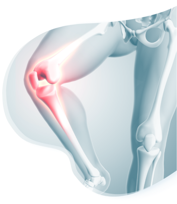 x-ray image of the leg representing pain in the knee joint