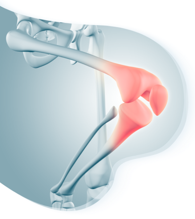 image of knee joint representing pain