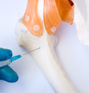 image of injection needle pointing at the bone model