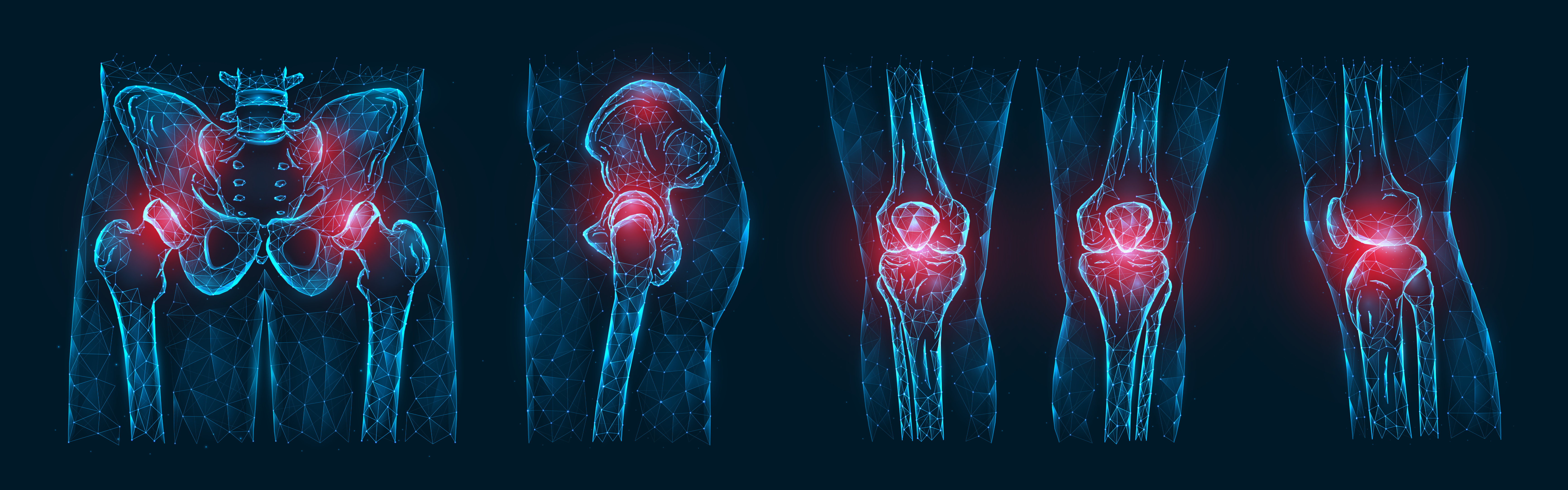 Preventing DVT/PE After Total Hip and Total Knee Arthroplasty: A Patient’s Comprehensive Guide